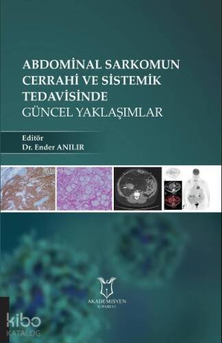 Abdominal Sarkomun Cerrahi ve Sistemik Tedavisinde Güncel Yaklaşımlar - 1