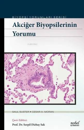 Akciğer Biyopsilerinin Yorumu - Biyopsi Yorumları Serisi - 1