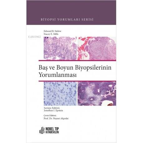 Biyopsi Yorumları Serisi:Baş Ve Boyun Biyopsilerinin Yorumlanması - 1