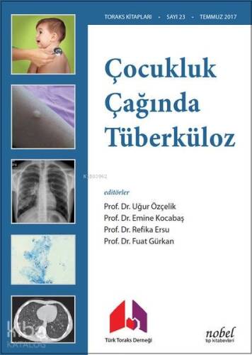 Çocukluk Çağında Tüberküloz - 1