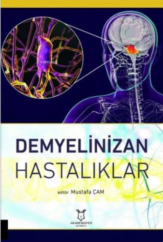 Demyelinizan Hastalıklar - 1