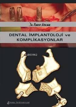 Dental İmplantoloji Ve Komplikasyonlar - 1