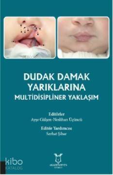 Dudak Damak Yarıklarına Multidisipliner Yaklaşım - 1