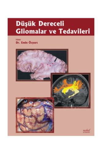 Düşük Dereceli Gliomalar Ve Tedavileri - 1