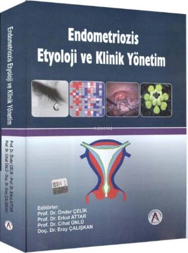 Endometriozis etyoloji ve klinik yönetim - 1