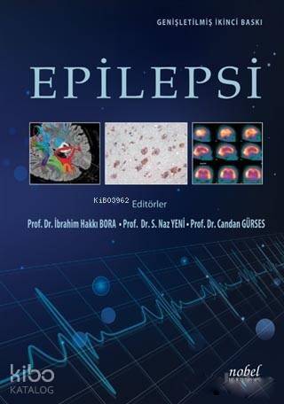 Epilepsi - 1