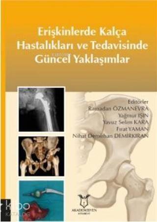 Erişkinlerde Kalça Hastalıkları ve Tedavisinde Güncel Yaklaşımlar - 1