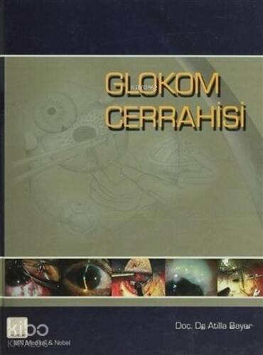 Glokom Cerrahisi - 1