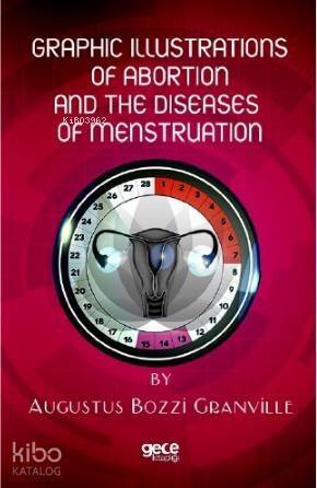 Graphic İllustrations Of Abortion And The Diseases Of Menstruation - 1