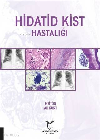 Hidatid Kist Hastalığı - 1