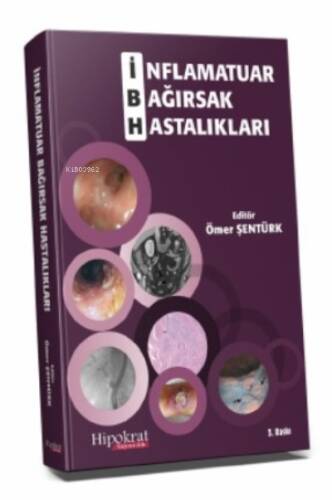 İnflamatuar Bağırsak Hastalıkları - 1