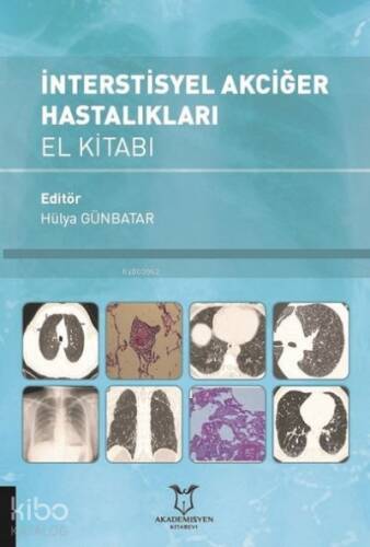 İnterstisyel Akciğer Hastalıkları El Kitabı - 1