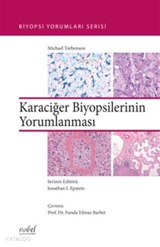 Karaciğer Biyopsilerinin Yorumlanması - 1