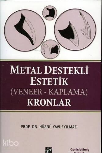 Metal Destekli Estetik (Veneer - Kaplama) Kronlar - 1