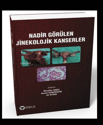 Nadir Görülen Jinekolojik Kanserler - 1