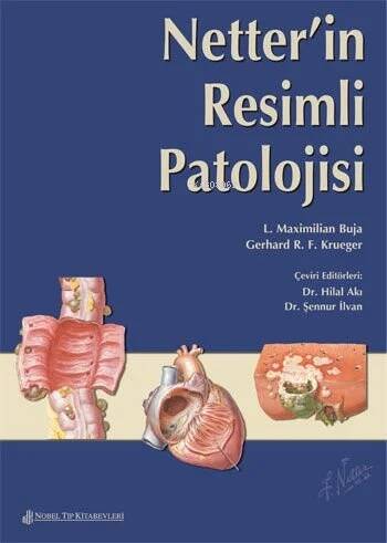 Netter'İn Resimli Patolojisi - 1