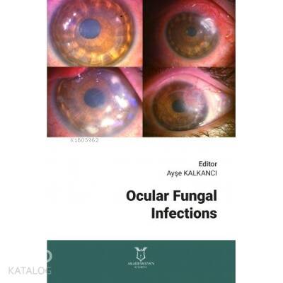 Ocular Fungal Infections - 1