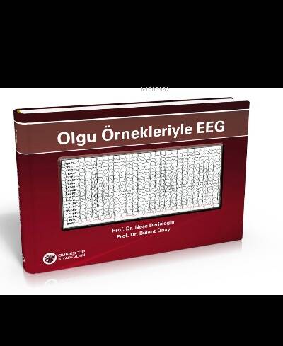 Olgu Örnekleriyle EEG - 1