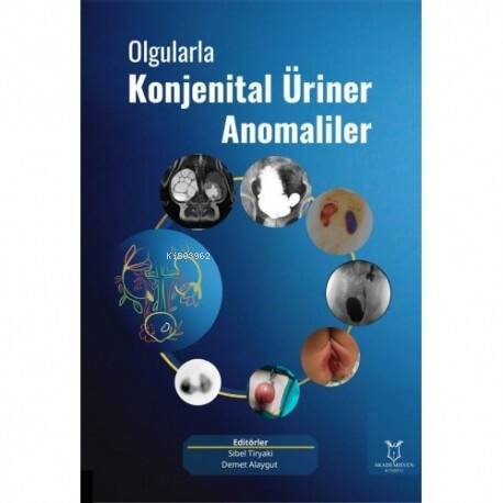 Olgularla Konjenital Üriner Anomaliler - 1