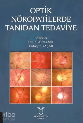 Optik Nöropatilerde Tanıdan Tedaviye - 1