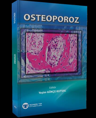 Osteoporoz - 1