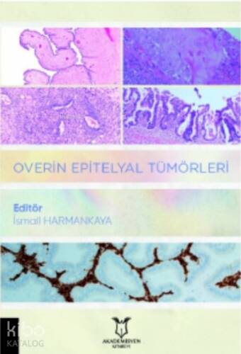 Overin Epitelyal Tümörleri - 1