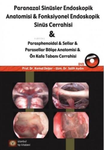 Paranazal Sinüsler Endoskopi Anatomisi & Fonksiyonel Endoskopik Sinüs Cerrahisi DVD'li - 1