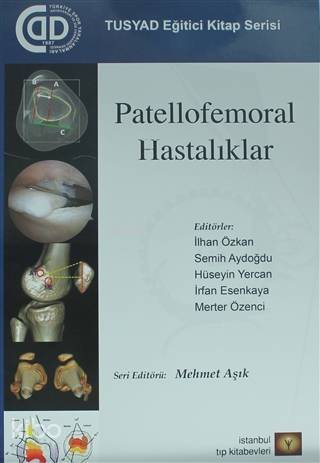 Patellofemoral Hastalıklar - 1