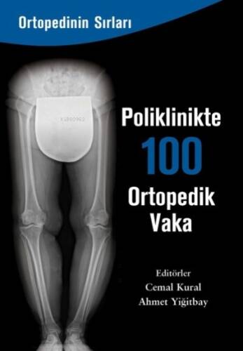 Poliklinkte 100 Ortopedik Vaka - 1