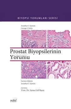 Prostat Biyopsilerinin Yorumu - 1