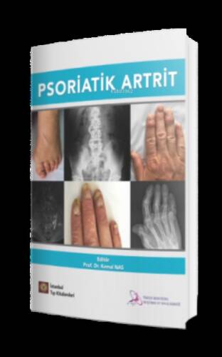 Psoriatik Artrit - 1