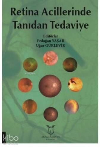 Retina Acillerinde Tanıdan Tedaviye - 1