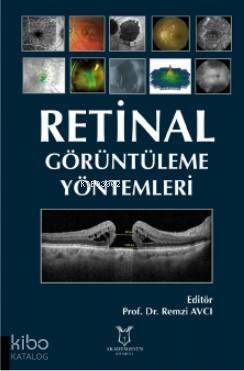 Retinal Görüntüleme Yöntemleri - 1