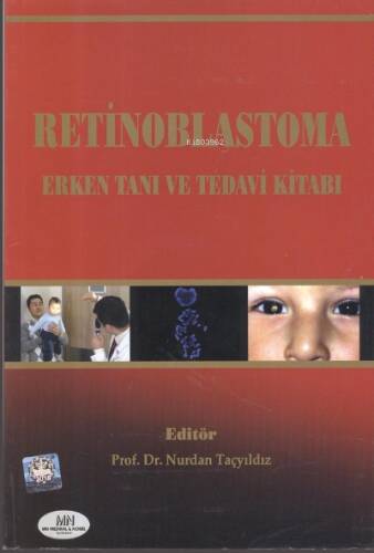 Retinoblastoma Erken Tanı ve Tedavi - 1