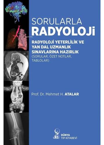 Sorularla Radyoloji: Radyoloji Yeterlilik Ve Yan Dal Uzmanlık Sınavlarına Hazırlık (Sorular, Özel Notlar, Tablolar) - 1