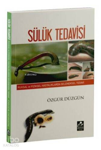 Sülük Tedavisi; Ruhsal ve Fiziksel Hastalıklarda Geleneksel Tedavi - 1