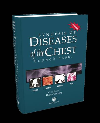 Synopsis of Diseases of The Chest (Türkçesi) - 1