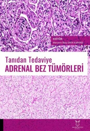 Tanıdan Tedaviye Adrenal Bez Tümörleri - 1