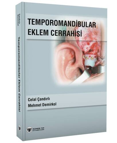 Temporomandibular Eklem Cerrahisi - 1