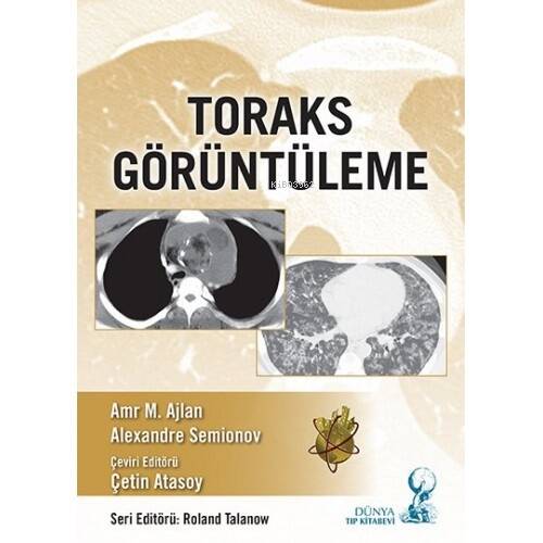 Toraks Görüntüleme - 1