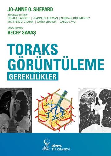 Toraks Görüntüleme:Gereklilikler - 1