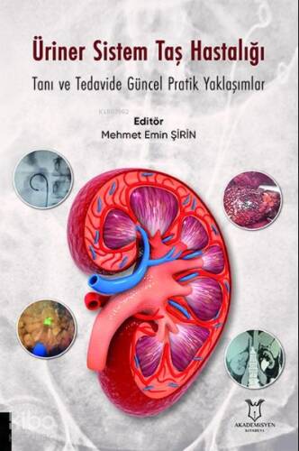 Üriner Sistem Taş Hastalığı: Tanı ve Tedavide Güncel Pratik Yaklaşımlar - 1