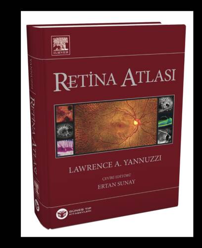 Yannuzzi Retina Atlası - 1