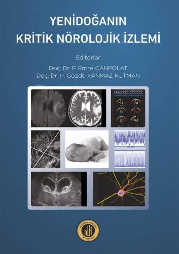 Yenidoğanın Kritik Nöroloji İzlemi - 1